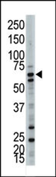 UBQLN3 Antibody (C-term)