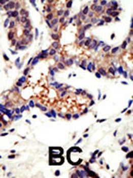 Ubiquilin3 Antibody (N-term)