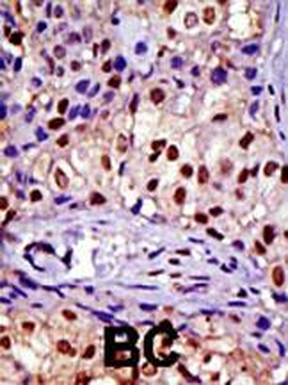 RAD23A Antibody (C-term)