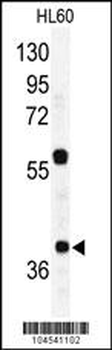 RAD23A Antibody (C-term)