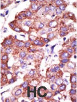 TOLLIP Antibody (C-term)
