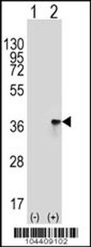 TOLLIP Antibody (C-term)