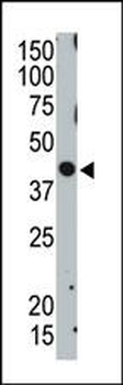 TSG101 Antibody (C-term)