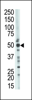 TSG101 Antibody (N-term)