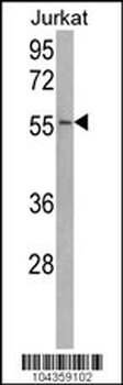 USP22 Antibody (C-term)