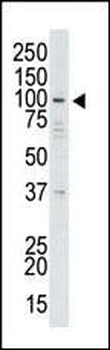 USP13 Antibody (Center)