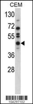 USP12 Antibody (N-term)