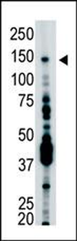 USP7 (HAUSP) Antibody (C-term)