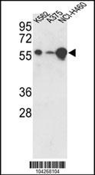 USP3 Antibody (C-term)