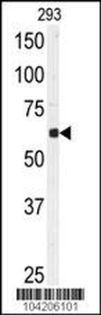 USP3 Antibody (N-term)