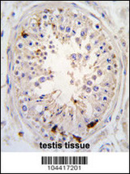 USP2 Antibody (C-term L523)