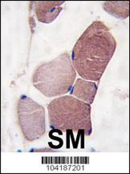 UCHL3 Antibody (C-term)