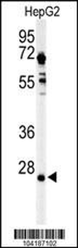 UCHL3 Antibody (C-term)