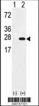 UCHL3 Antibody (C-term)