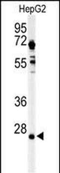 UCHL3 Antibody (C-term)