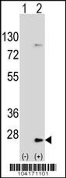 UBE2H Antibody (C-term)