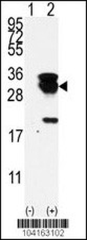 E2EPF Antibody (N-term)