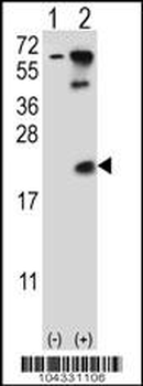 UBE2B Antibody (C-term)