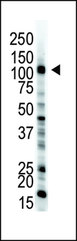 E1 Ubiquitin (UBE1) Antibody (C-term)