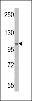 E1 Ubiquitin (UBE1) Antibody (C-term)