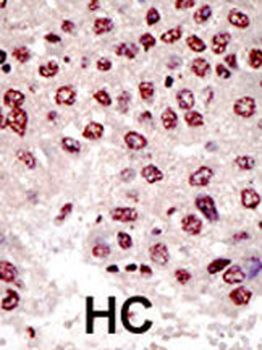 UBE4B Antibody (N-term)