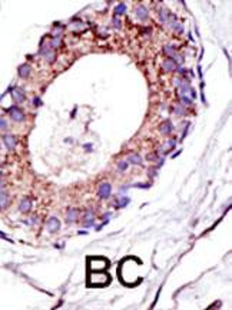 UBE4A Antibody (C-term)