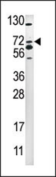 SMURF2 Antibody (C-term)