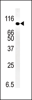 SMURF1 Antibody (N-term)