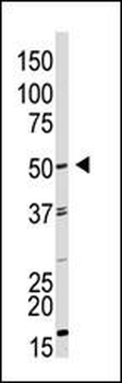 GDF9 Antibody (N-term)