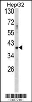 GDF1 Antibody (N-term)