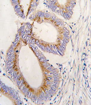 GDF11 Antibody (N-term)