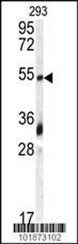 GDF10 Antibody (N-term)