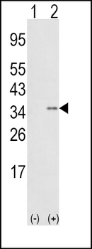 SNAI1 Antibody (N-term D24)