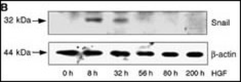 SNAI1 Antibody (N-term D24)