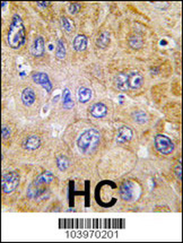 THY1 Antibody (N-term)