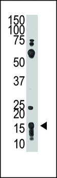 THY1 Antibody (N-term)