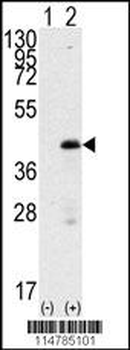 SOX2 Antibody (A30)