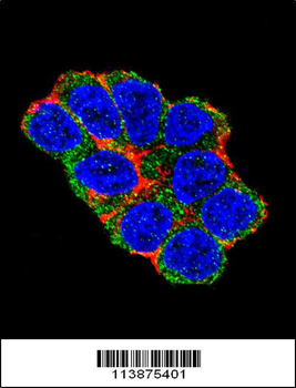 SOX2 Antibody (Center)