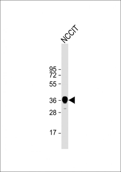 SOX2 Antibody (Center)