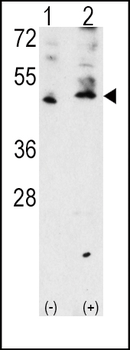 VEGFC (VEGF3) Antibody (Center M263)