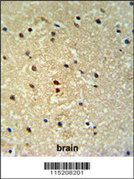 PROX-1-S514 Antibody