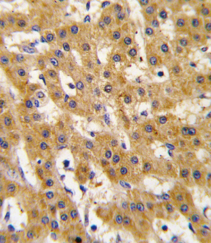 PDX1 Antibody (T11)