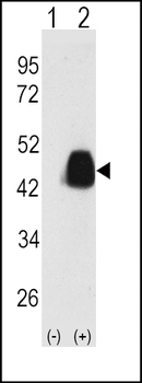 PDX1 Antibody (T11)
