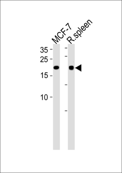 CNBP Antibody (Center)
