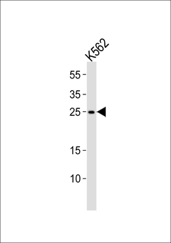 RAB27A Antibody (C-term)
