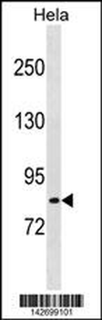 LRCH1 Antibody (Center)