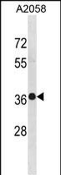 TRUB2 Antibody (Center)