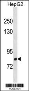 CMIP Antibody (C-term)