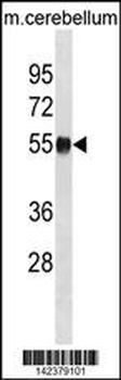 Mouse Ppm1h Antibody (Center)