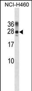 Rat Ppp1r2 Antibody (Center)